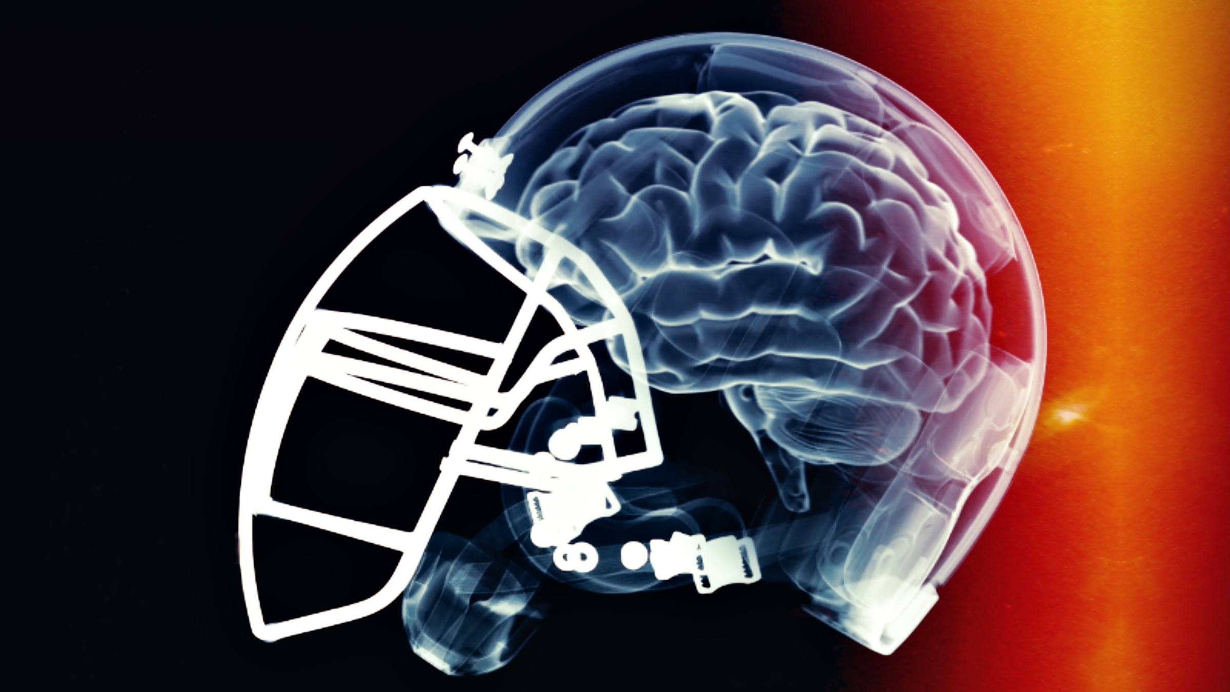 The NFL is researching if Marijuana can help athletes manage their pain and concussions