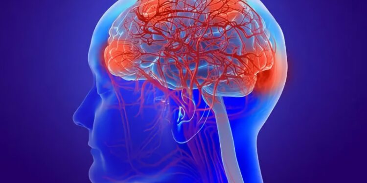 Marijuana Use Tied to Epilepsy?
